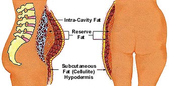 celluliteclear